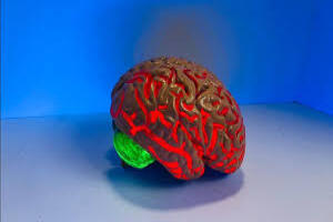 Blog Post Image